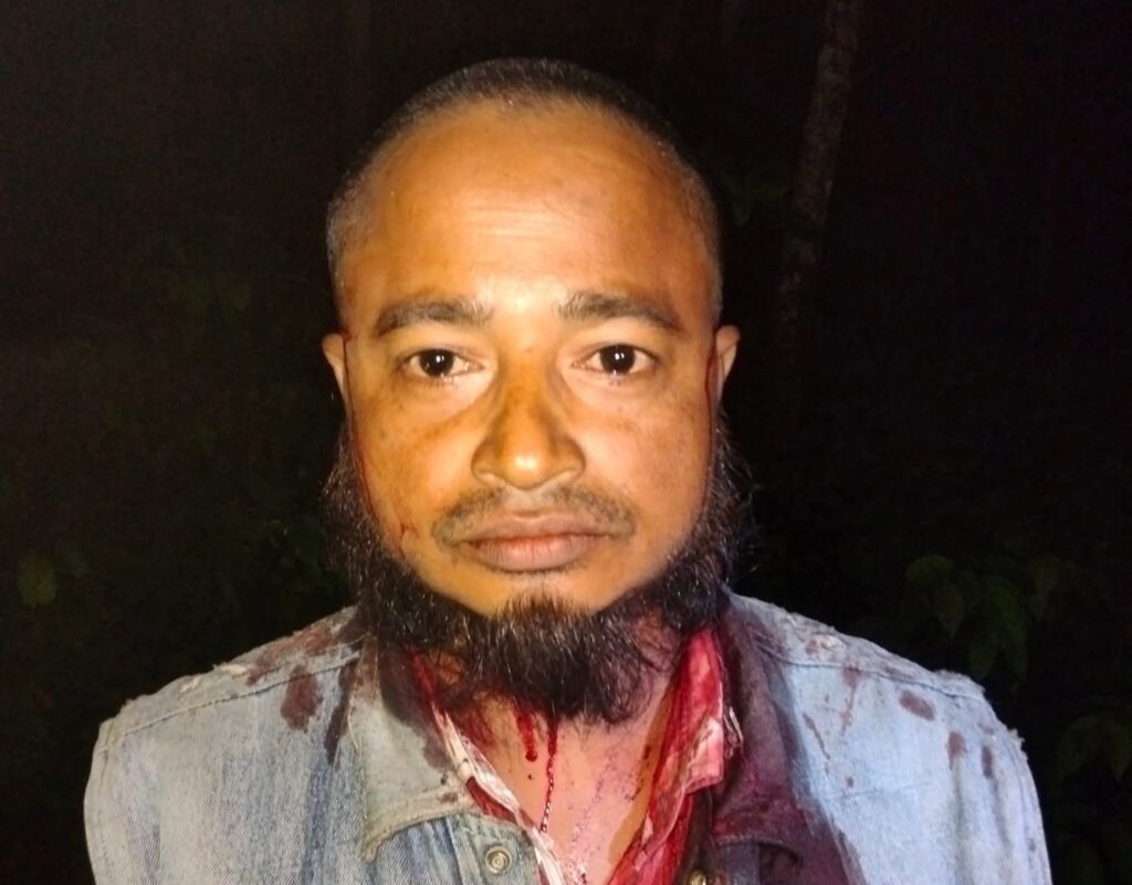 চকরিয়ায় চালকের মাথা ফাটিয়ে অটোরিকশা ছিনতাইয়ের চেষ্টা, পুলিশের অভিযানে একজন আটক