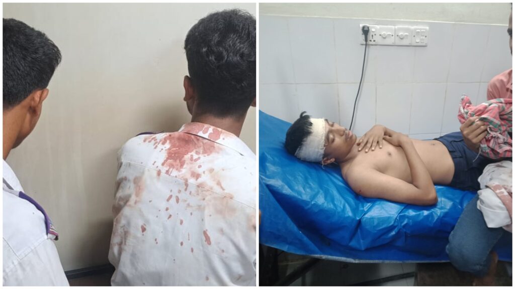 উখিয়ায় প্রাইভেট পড়ে ফেরার পথে শিক্ষার্থীদের ওপর হামলা