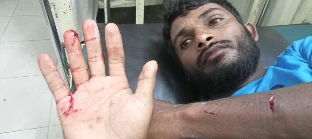 ঈদগাঁওয়ে লুডু খেলতে বাঁধা দেয়ায় যুবককে ছুরিকাঘাত ঈদগাঁওয়ে লুডু খেলতে বাঁধা দেয়ায় যুবককে ছুরিকাঘাত
