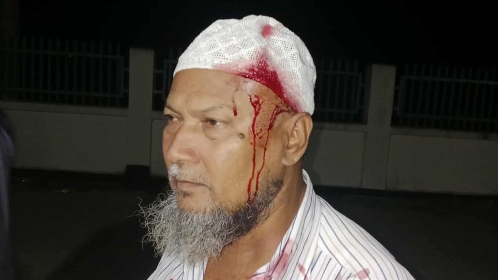 ঈদগাঁওয়ে জুয়ার আসরে বাঁধা দেয়ায় রক্ত ঝরল বৃদ্ধ মুসল্লির ঈদগাঁওয়ে জুয়ার আসরে বাঁধা দেয়ায় রক্ত ঝরল বৃদ্ধ মুসল্লির