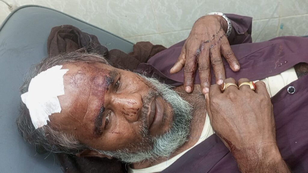 কুতুবদিয়ায় প্রতিপক্ষের হামলায় আহত ৪ কুতুবদিয়ায় প্রতিপক্ষের হামলায় আহত ৪