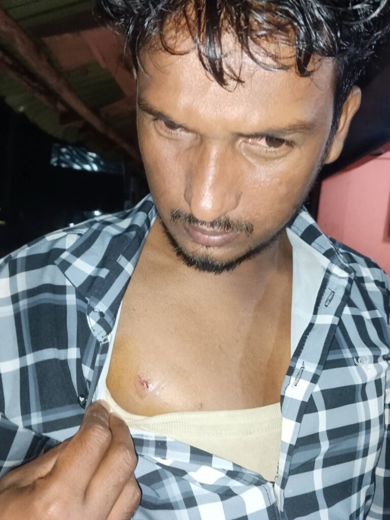 ঈদগাঁওয়ে ছিনতাই ঘটনার স্বাক্ষীদের ছুরিকাঘাত ও মারধরের অভিযোগ